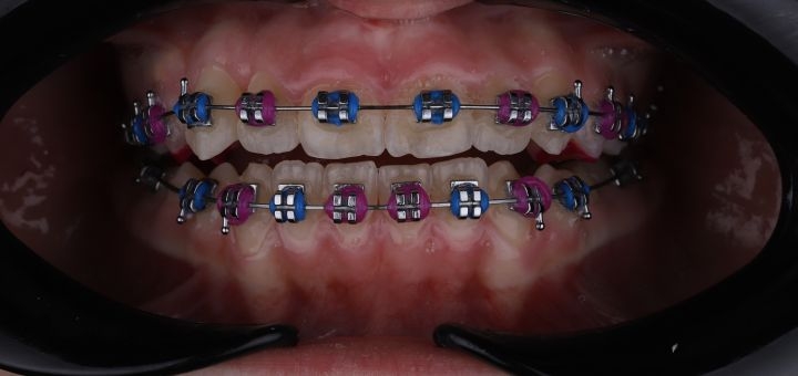 Dentist orthodontist in kiev, discounts on services