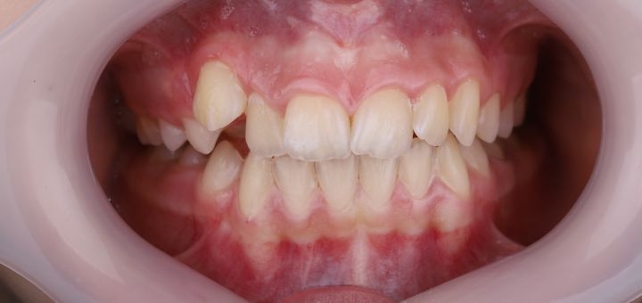 Dentist orthodontist in kiev, discounts on services