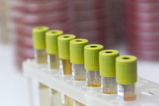 Лабораторія «Invitro». Знижки на аналізи